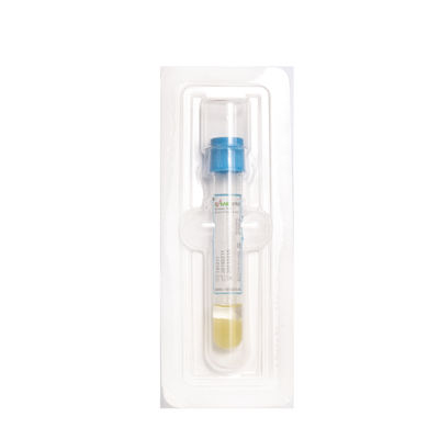 De Reageerbuis van 8ML PRP