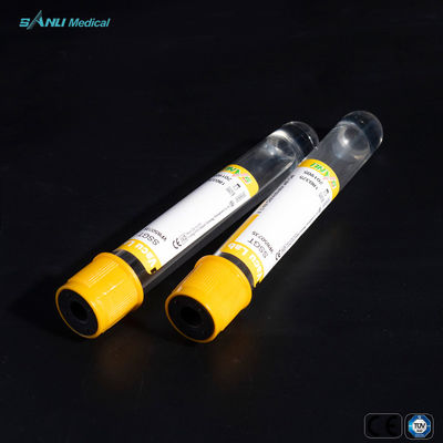 SSGT-de Inzamelingsbuizen 8ml van het Glasbloed met Klonteractivator en Gel