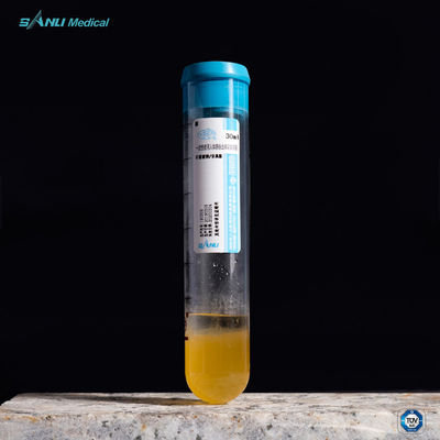 Verlicht Pijnprp Reageerbuis 20ml acd-a met GEL voor OA-Behandeling